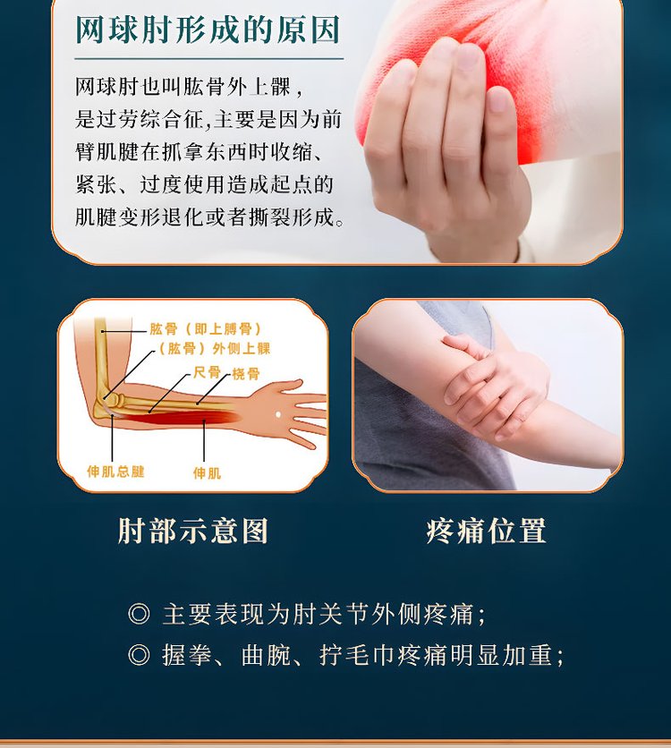網球肘形成的原因